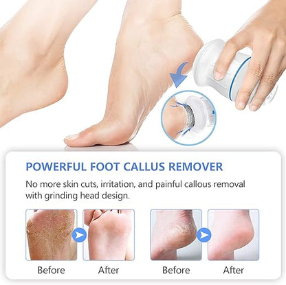 Electric foot grinder tool Pedicure